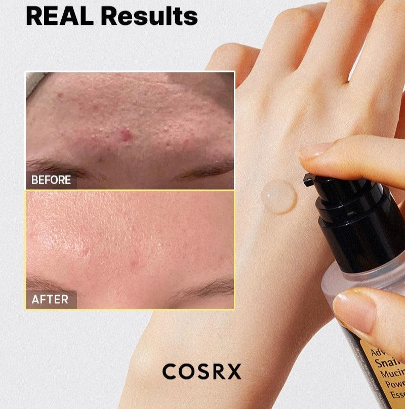advanced-snail-96-mucin-power-essence-cosrx-official-6 advanced-snail-96-mucin-power-essence-cosrx-official-6